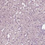 PLA2R1 Antibody in Immunohistochemistry (Paraffin) (IHC (P))