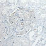 PLA2R1 Antibody in Immunohistochemistry (Paraffin) (IHC (P))