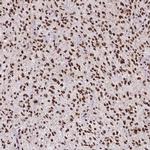 ATRX Antibody in Immunohistochemistry (IHC)