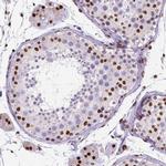 ATRX Antibody in Immunohistochemistry (IHC)