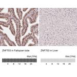ZNF703 Monoclonal Antibody (CL0654)