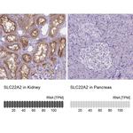 SLC22A2 Antibody