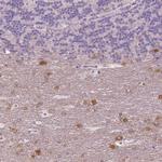 NECAB1 Antibody in Immunohistochemistry (Paraffin) (IHC (P))