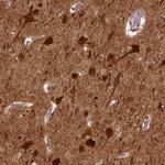 NECAB1 Antibody in Immunohistochemistry (Paraffin) (IHC (P))