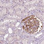 NECAB1 Antibody in Immunohistochemistry (Paraffin) (IHC (P))