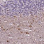 NECAB1 Antibody in Immunohistochemistry (Paraffin) (IHC (P))