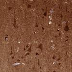 NECAB1 Antibody in Immunohistochemistry (Paraffin) (IHC (P))