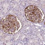 NECAB1 Antibody in Immunohistochemistry (Paraffin) (IHC (P))