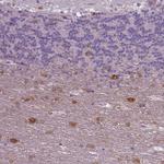 NECAB1 Antibody in Immunohistochemistry (Paraffin) (IHC (P))