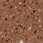 NECAB1 Antibody in Immunohistochemistry (Paraffin) (IHC (P))