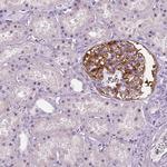NECAB1 Antibody in Immunohistochemistry (Paraffin) (IHC (P))