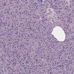 NECAB1 Antibody in Immunohistochemistry (Paraffin) (IHC (P))