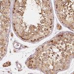 PGAM5 Antibody in Immunohistochemistry (Paraffin) (IHC (P))