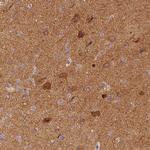 NECAB2 Antibody in Immunohistochemistry (Paraffin) (IHC (P))