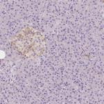 NECAB2 Antibody in Immunohistochemistry (Paraffin) (IHC (P))