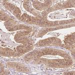 NAPRT1 Antibody in Immunohistochemistry (Paraffin) (IHC (P))