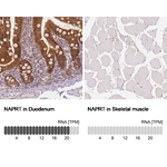 NAPRT1 Antibody in Immunohistochemistry (Paraffin) (IHC (P))