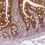 NAPRT1 Antibody in Immunohistochemistry (Paraffin) (IHC (P))
