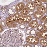NAPRT1 Antibody in Immunohistochemistry (Paraffin) (IHC (P))