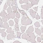 NAPRT1 Antibody in Immunohistochemistry (Paraffin) (IHC (P))