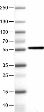 NAPRT1 Antibody in Western Blot (WB)