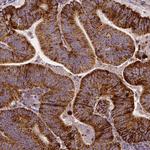 MACC1 Antibody in Immunohistochemistry (Paraffin) (IHC (P))