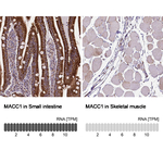 MACC1 Antibody in Immunohistochemistry (Paraffin) (IHC (P))