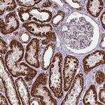 MACC1 Antibody in Immunohistochemistry (Paraffin) (IHC (P))