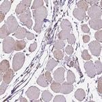 MACC1 Antibody in Immunohistochemistry (Paraffin) (IHC (P))