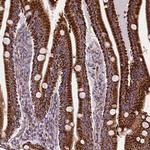 MACC1 Antibody in Immunohistochemistry (Paraffin) (IHC (P))