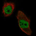 NSD2 Monoclonal Antibody (CL1057)