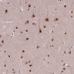 NSD2 Antibody in Immunohistochemistry (Paraffin) (IHC (P))
