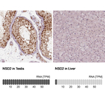 NSD2 Antibody in Immunohistochemistry (Paraffin) (IHC (P))