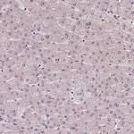NSD2 Antibody in Immunohistochemistry (Paraffin) (IHC (P))