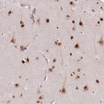 NSD2 Antibody in Immunohistochemistry (Paraffin) (IHC (P))