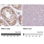 NSD2 Antibody in Immunohistochemistry (Paraffin) (IHC (P))