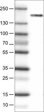 NSD2 Antibody in Western Blot (WB)