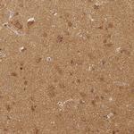 RHOT1 Monoclonal Antibody (CL1083)