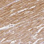 RHOT1 Antibody in Immunohistochemistry (IHC)