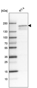 KDM5B Monoclonal Antibody (CL1147)