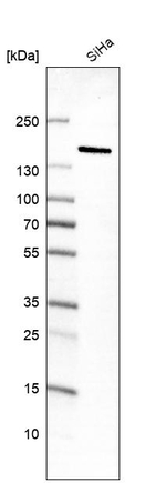 MKL2 Antibody in Western Blot (WB)
