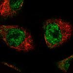 MKL2 Monoclonal Antibody (CL1546)