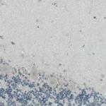 ITIH4 Antibody in Immunohistochemistry (Paraffin) (IHC (P))