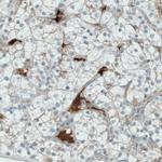 ITIH4 Antibody in Immunohistochemistry (Paraffin) (IHC (P))