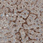 ITIH4 Antibody in Immunohistochemistry (Paraffin) (IHC (P))
