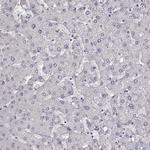 MYH6 Antibody in Immunohistochemistry (IHC)
