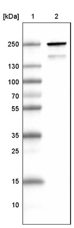 MYH6 Antibody in Western Blot (WB)