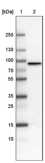 CARS Antibody in Western Blot (WB)