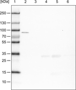 CARS Antibody in Western Blot (WB)