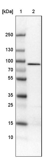 CARS Antibody in Western Blot (WB)